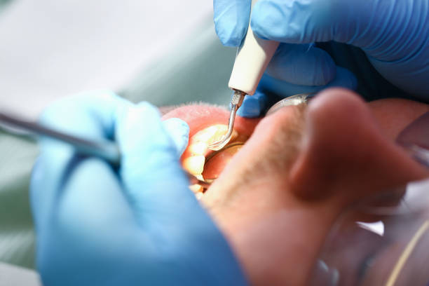 Best Emergency Denture Repair in Verona, MS