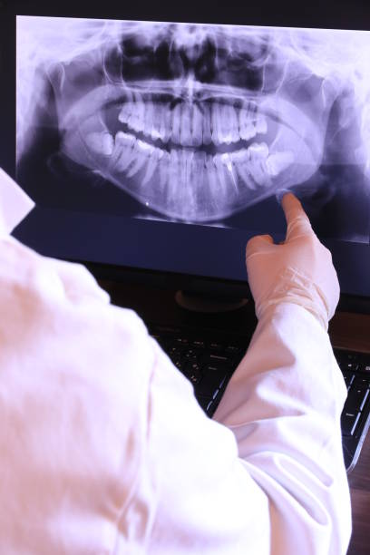 Best Urgent Care for Lost Fillings or Crowns in Verona, MS