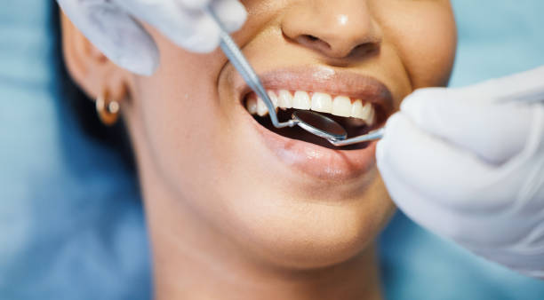 Best Emergency Tooth Extraction in Verona, MS